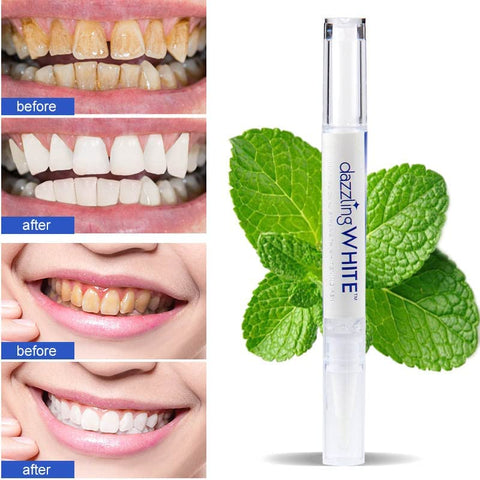 Instant teeth whitening pen