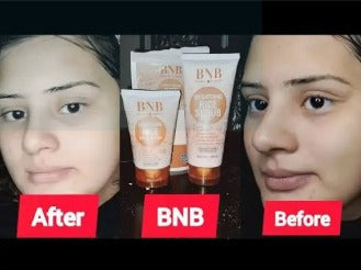 BNB Rice Organic Facial Kit